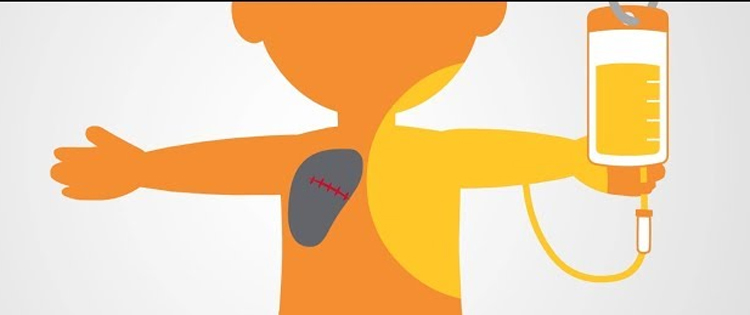Cancer Treatment: Chemotherapy